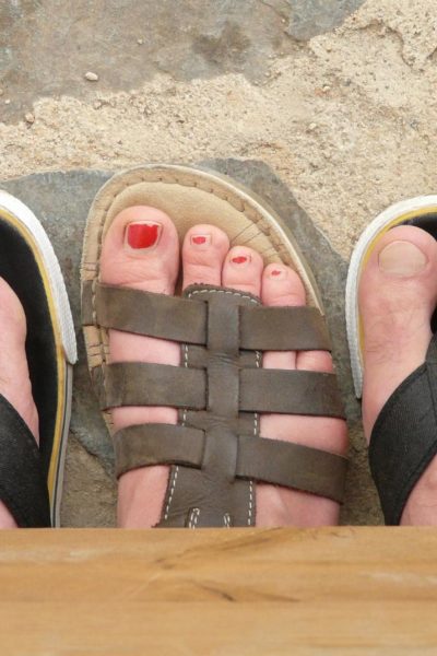 the truth about fungal nail infection and the treatment options available