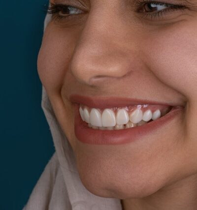 5 smile friendly habits that extend the life of cosmetic dental procedures