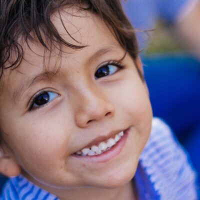 The Role Of Preventive Dentistry In Supporting Children With Special Needs