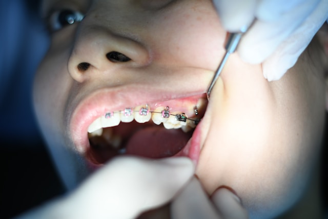 5 advantages of orthodontic tracings in treatment planning