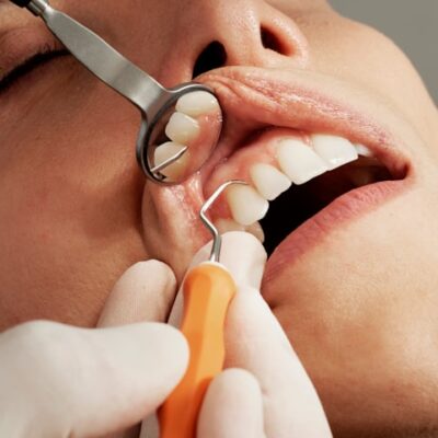 Why General Dentistry Is Key To Detecting Oral Cancer Early