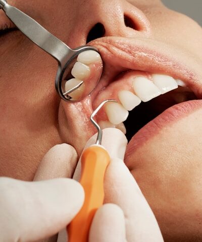 why general dentistry is key to detecting oral cancer early