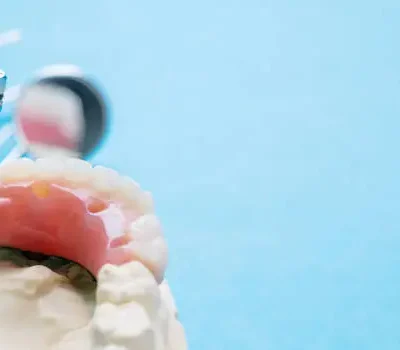 6 tips for choosing between dentures and implants