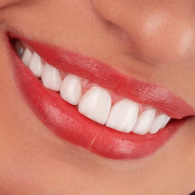5 Dental Cosmetic Enhancements That Pair Well With Regular Dental Checkups