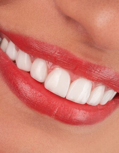 5 dental cosmetic enhancements that pair well with regular dental checkups