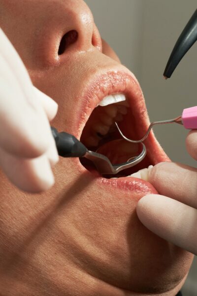 how general dentistry encourages early intervention