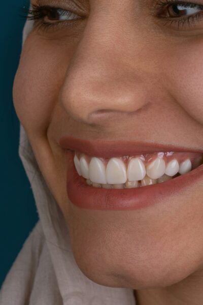 6 tips for protecting your smile during orthodontic treatment