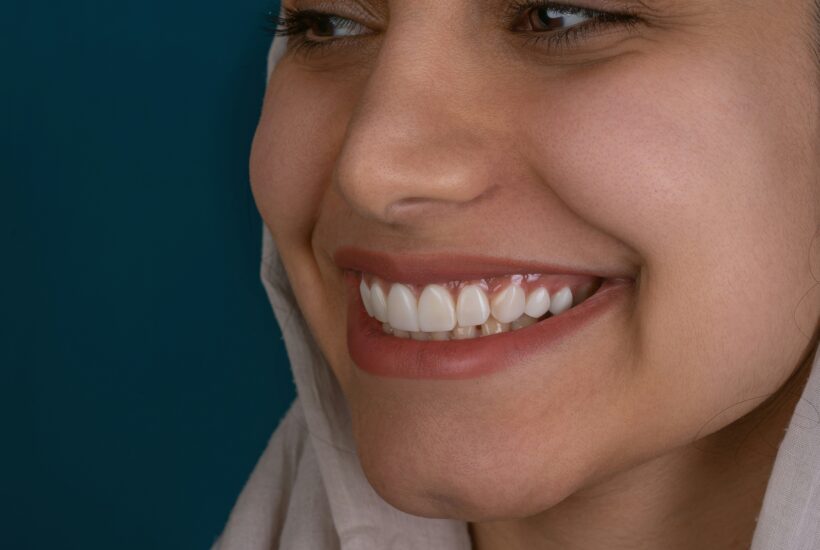 Kamal hoseinianzade 4lxmfcxkwc4 unsplash Flurl why tidal aligners are designed for comfort and precision