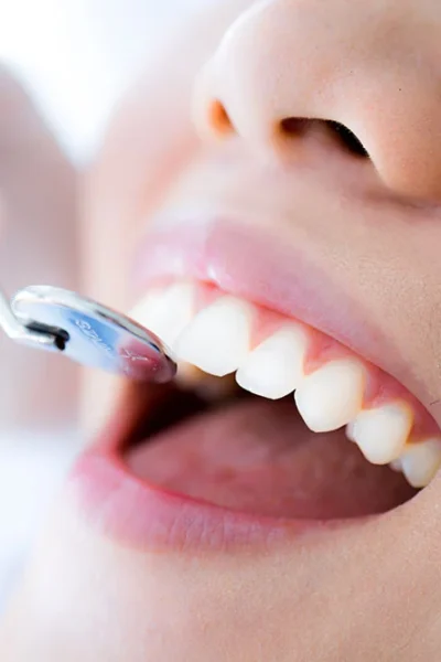 6 breakthrough tools improving preventive dental screenings