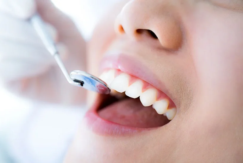 6 breakthrough tools improving preventive dental screenings