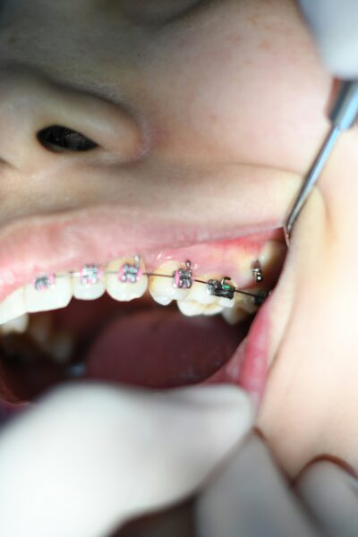 Atikah akhtar hkaylaf1ndw unsplash 2 Flurl 5 ways orthodontists help manage complex dental cases