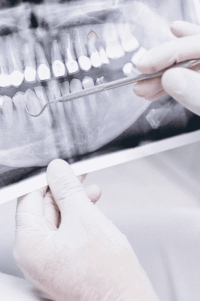 Screen shot 2020 05 08 at 22901 pm Flurl understanding the role of x rays in general dental care