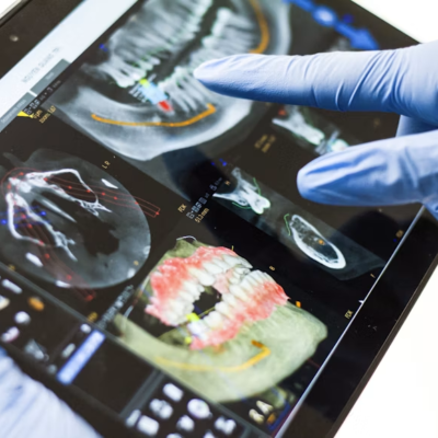 How Technology Improves Accuracy In Dental Restorations